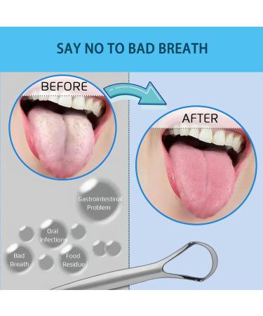 4-Piece Stainless Steel Tongue Cleaner Set | Combat Bad Breath & Freshen Breath Fast | Eco-Friendly & Easy to Clean - Buy Online on GoSupps.com