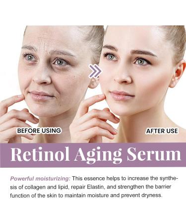 Instant Face Lift Serum Retinol Anti Wrinkles Face Serum Hyaluronic Acid Face Serum for Loose Contour & Fine Lines Nourishing Serum Advanced Night Serum High Tightening for Aging Skin - Buy Online on GoSupps.com