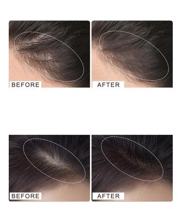 Waverlo Hair Line Powder - Blonde Root Touch Up & Coverage for Thinning Hair | Instant Volumizing & Gray Hair Concealer - Buy Online on GoSupps.com