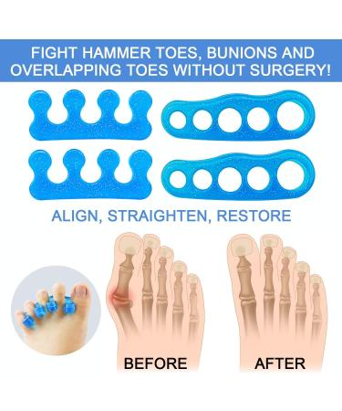 Premium Gel Toe Separators for Men & Women - Toe Straighteners, Spacers, Hammer Toe & Bunion Corrector - Ideal for Yoga, Running & Pedicure - Buy Online on GoSupps.com
