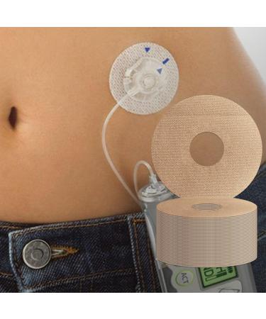 Universal Adhesive Patches for CGM and Insulin Pumps 0.8-Inch Hole 40 Pack Waterproof & Breathable CGM Patches Long Last Sensor Patches Pre-Cut Adhesive Tape CGM Protection Skin-Friendly Patches Beige 40 Count (Pack of 1)