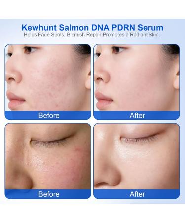 30e Salmon DNA PDRN Anti-Aging Facial Serum + 5ea Madecassoside Sheet Mask Blemish Repair - Buy Online on GoSupps.com