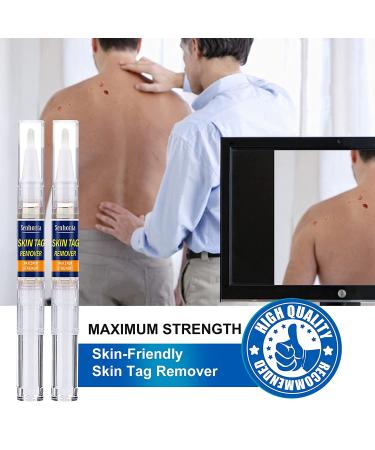 Extra Strength Skin Tag Remover | Wart Removal | Tag Dries and Falls Away | Natural Ingredients | All Skin Types - Buy Online on GoSupps.com