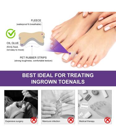 Ingrown Toenail Treatment Kit | Pain Relief Tool for Easy Trimming | Soften Nails & Straighten | Toenail Pain Relief Oil Drops | Natural 50 Patch Treatment - Buy Online on GoSupps.com