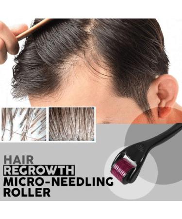 Beard Growth and Hair Regrowth 540 Titanium Microneedling Roller Against Hair Loss Treatment Bald Spots Beauty Tool Gold 0.25mm - Buy Online on GoSupps.com