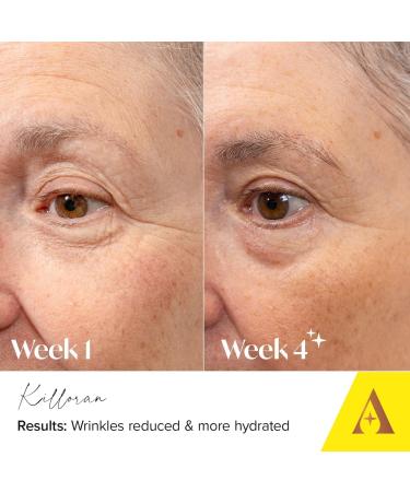 Absolute Collagen Deep Lift Eye Cream 15ml - Radiance Boosting - De-Puff and Brighten Dark Circles - Reduce Appearance of Fine Lines & Wrinkles - Collagen Boosting Anti-Ageing Formula - Firm & Tighten - Buy Online on GoSupps.com