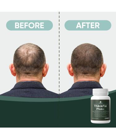 Thik&Fix Plus Natural Hair Nutrition Supplement - Vitamins & Herbs for Thinning Hair 30 Capsules - Buy Online on GoSupps.com