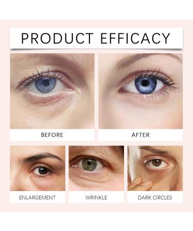  yxcully Retinol Eye Contour Cream Stick Turmeric and retinol eye contour stick for dark circles and puffiness anti-aging hydration reduces fine lines and wrinkles brightens and moisturizes (1 pc) - Buy Online on GoSupps.com