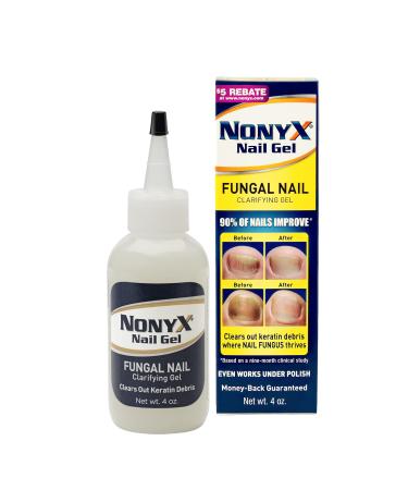 NONYX Nail Gel, a Toenail Fungus Treatment that Clears out Fungus by Removing Keratin Debris where Nail Fungus Grows, 90% of Nails Improve, 4 fl oz