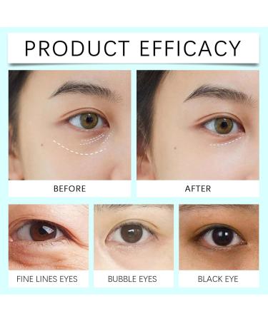 Mihauuke Eye Repair Cream | Moisturizing Under Eye Cream For Radiant Skin - Hydrating Under Eye Brightener Effective Eye Cream For Puffiness And Bags Under Eyes - Buy Online on GoSupps.com