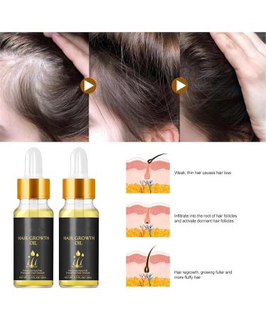 2024 New Folix 22 Hair Growth S rum de croissance des cheveux formule de croissance des cheveux huile de croissance des cheveux biotine s rum paississant base d'herbes huile de croissance des 3 pi ces - Buy Online on GoSupps.com