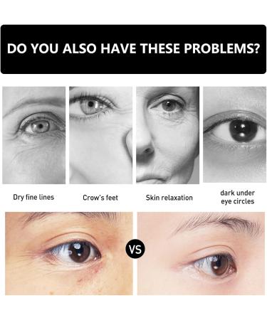 Instant Firmx Eye Tightener - Eye Bag Cream - Instant Firm Eye Cream for Dark Circles - Reduce Eye Bags Puffiness - Fade Fine Lines - Anti-Aging Eye Cream For All Skin - Buy Online on GoSupps.com