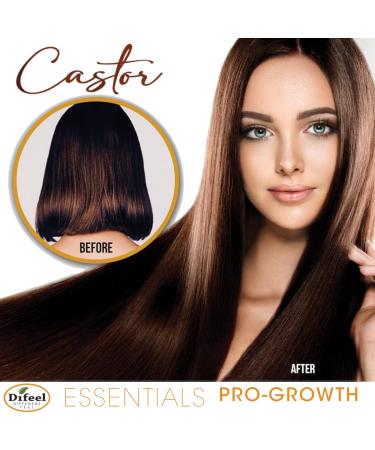 Buy Difeel Essentials Pro-Growth Castor Hair Mist 6 oz | Nourish & Strengthen Hair | Fast International Shipping - Buy Online on GoSupps.com