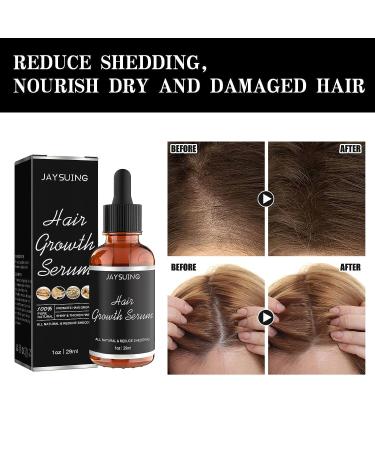 Allurium Hair Growth Serum for Black Women - 2023 New Formula | Anti Hair Loss, Nourishes & Revitalizes Dry Damaged Hair | Fast Natural Growth (3PCS) - Buy Online on GoSupps.com