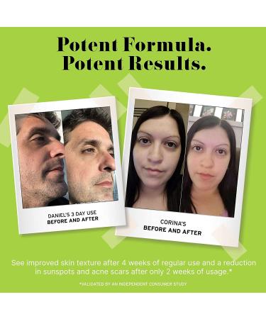 No B.S. Caffeine Eye Cream | Under Eye Cream for Dark Circles & Puffiness | Vegan Skin Care with Hyaluronic Acid & Squalane | 0.5 FL Oz Travel Size - Buy Online on GoSupps.com