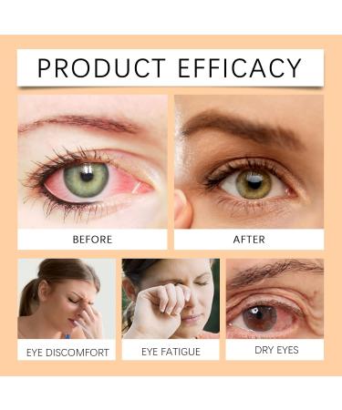VKaoess Organic honey eye cream Honey serum for under the eyes Nourishing and moisturizing gel for the eyes deep hydration for the skin around the eyes for daily care 30 ml 3 bottles - Buy Online on GoSupps.com