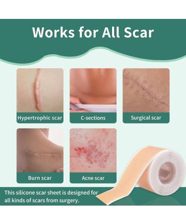 Medical Grade Silicone Scar Sheets (1.57 x 60) - Effective Scar Removal Strips for Acne & Burn Scars - Buy Online on GoSupps.com