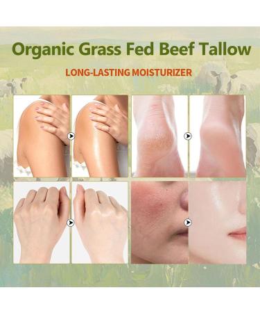 Vbolre Grass Fed Beef Tallow with Frankincense Oil and Castor Oil Organic Grass Fed Beef Tallow for Skin Whipped Beef Tallow Frankincense Oil Castor Oil for Skin Face Body Moisturizer (1) - Buy Online on GoSupps.com