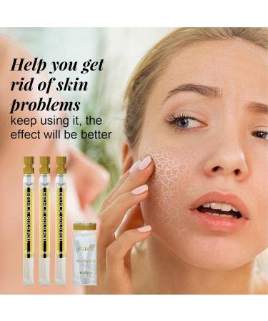  Stronrive 3 Facial Lifting Protein - Absorbable collagen protein thread for facial filling | Improves skin elasticity stretches the skinline - Buy Online on GoSupps.com