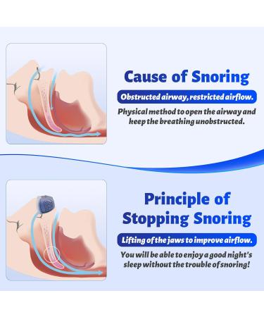Anti Snoring Devices - Effective Snoring Solution for Men & Women | Adjustable & Breathable | All Nose Shapes - Shop Now - Buy Online on GoSupps.com