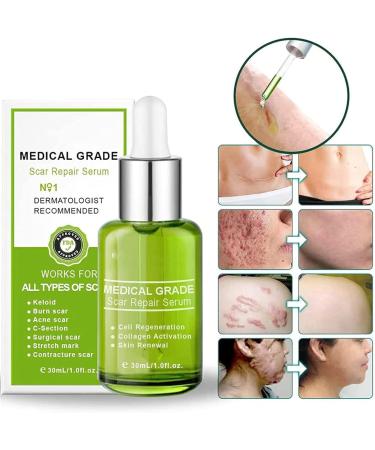 Essence r paratrice de cicatrices avanc e naturelle s rum r parateur de cicatrices de qualit m dicale r pare et lisse la peau pour tous types de cicatrices 1Pcs - Buy Online on GoSupps.com