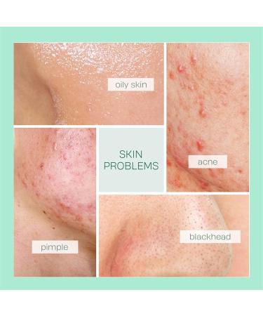 Clay Face Mask Set - Deep Pore Cleansing Clay Mask - Sakura Tea Tree Gift Sets for Teenage Girls - Face Masks Skincare Long Lasting Hydration - Face Masks Beauty for Acne Treatment & Control Oil - Buy Online on GoSupps.com