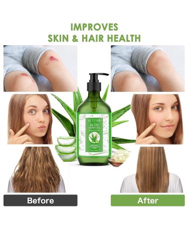 YETESON Aloe Vera Gel After Sun - Natural Organic Skin Care for Hydrating & Soothing Face, Body, Hair & Hands - Sunburn Relief & After Shave Cooling Cream - 17fl oz/ 500ml - Buy Online on GoSupps.com