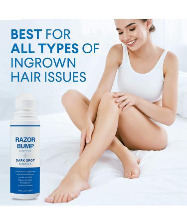 Razor Bump Stopper & Dark Spot Remover: Ingrown Hair Treatment for Men & Women - Buy Online on GoSupps.com