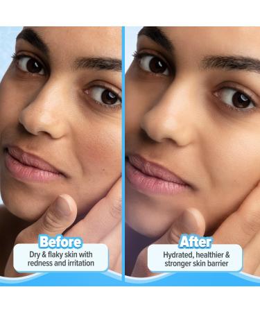 5 Barrier+ Repair Moisturizer with Avocado & Ceramides - 100g | Strengthen Skin Barrier & Deeply Moisturize | International Shipping Available - Buy Online on GoSupps.com