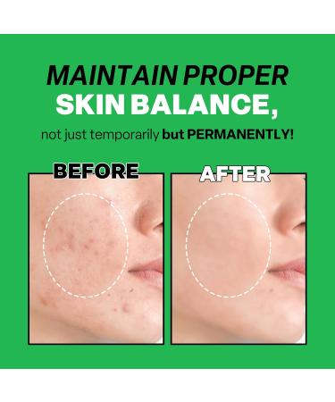 Troubless Mild Clear Toner Essence - Hydrating & Soothing Tea Tree Facial Toner for All Skin Types | Moisturizing Daily Skin Care (6.76 fl oz - Buy Online on GoSupps.com