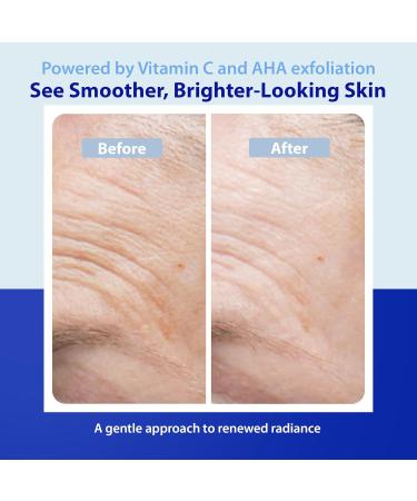 Dr. Denese Peel & Glow Rx Vitamin C Face Paste & AHA Peel Drops Set - Skin Care Exfoliating Peel Kit for Brighter Smoother Looking Skin - Dual-Action Facial Treatment - Clean Skin Care - Cruelty-free - Buy Online on GoSupps.com