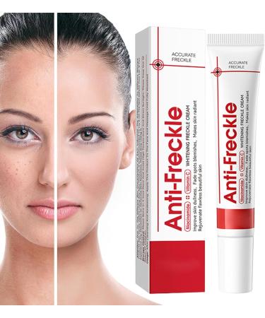 Freckle Remover For The Face Correcting Skin Imperfections Relieving & Repairing Face Cream for Skin Care Body and Women - Buy Online on GoSupps.com