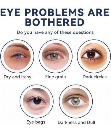 YANINEE 4 Pack Eye Gel Firming Eye Cream for Open Eyes Peptides Lifting Anti-Aging Eye Cream for Men Women - Buy Online on GoSupps.com