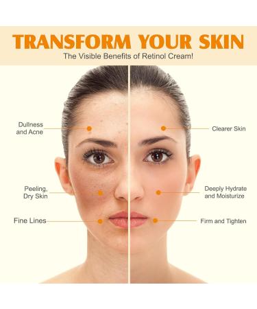 Beef tallow and honey balm for face moisturizing tallow cream for face and body skin care and lip balm herb fed beef tallow balm for skin care - Buy Online on GoSupps.com