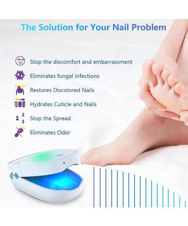 iKeener Portable Cold Laser Nail Fungus Treatment - Rechargeable Home Care Device for Painless Onychomycosis Cure - Buy Online on GoSupps.com