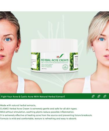 Beslibate herbal acne cream - 1.76 oz - Buy Online on GoSupps.com