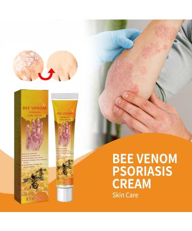 ROKOBN Bee Venom Psoriasis Treatment Cream - Professional Soothing & Moisturizing Skin Relief (4PCS) - Buy Online on GoSupps.com