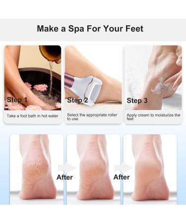 XinBarber Pedicure Sets for Feet Electric Foot File Callus Remover Waterproof Hard Skin Remover Foot with 3 Rollers and 2 Speeds Professional Pedicure Tools Gift Kit for Cracked Heels Callus Dead Skin - Buy Online on GoSupps.com