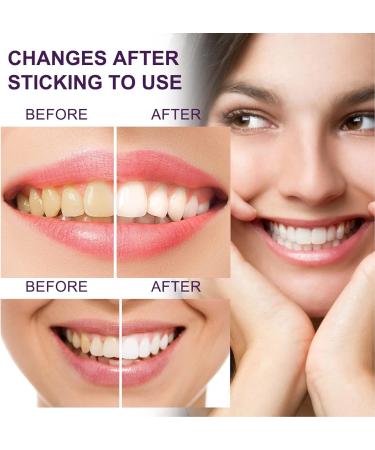 Angrek Purple Teeth Whitening Toothpaste - Color-Corrected Stain Removal & Gentle Deep Cleaning 50ml - Buy Online on GoSupps.com