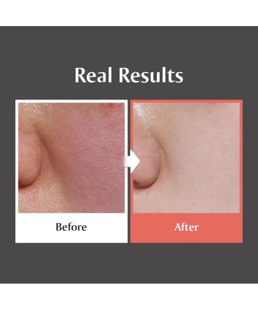 redence 5% Niacinamide & Triple Hyaluronic Acid Skin Barrier Moisturizer Cream for Even Tone Deep Hydration & Sensitive Skin Care 1.69 fl oz - Buy Online on GoSupps.com