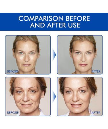 Boto Stock Solution Facial Serum - Boto-x Stock Anti Aging Serum For Face - Instant Face Tightening Boto Reduce Fine Lines Wrinkles Boost Skin Collagen Hydrate & Plump Skin 30ml - Buy Online on GoSupps.com