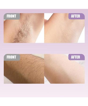 Rasoir lectrique pour femme tondeuse cheveux personnelle portable avec 3 t tes d'accessoires tondeuse de bikini pour femme pour cheveux visage bikini corps peau jambes beaut V - Buy Online on GoSupps.com