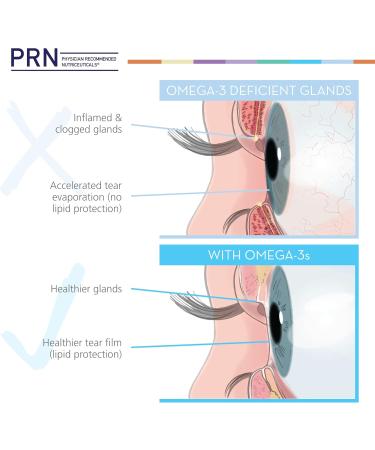 PRN DE Omega Benefits Liquid Supplement - 10 oz 60-Day Supply - Re-Esterified Omega 3 Triglyceride Form with 1680mg EPA 560mg DHA & Vitamin D for Dry Eye Support 60 Day Supply - Buy Online on GoSupps.com