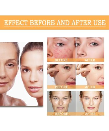 Glycolic Acid 7% Toning Resurfacing Solution - Glycolic Sour 7% Toner - Hydrating Toning Solution - Skincare Hyaluronic Acid Serum - for Blemishes and Acne Prevents Skin Aging Strengthen Your Skin - Buy Online on GoSupps.com