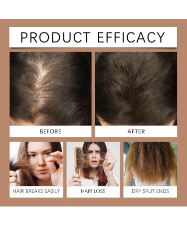 3in1 nourishing conditioning shampoo hair growth shampoo with rosemary batana Onion for men and women reduces hair loss 1 piece - Buy Online on GoSupps.com