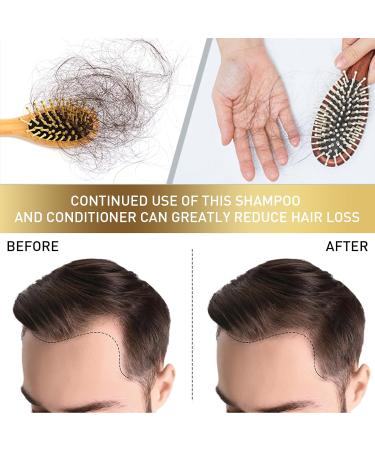 50g Hair Scalp Exfoliating Scrub Anti Hair Loss Treatment for Dandruff Flakes & Oily Scalp Nourishes Hair Follicles & Promotes Thicker Healthier Hair Growth - Buy Online on GoSupps.com