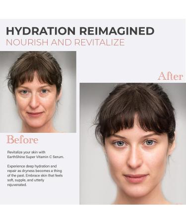 EarthShine Super C Serum for Women Over 70 | Hydrating Vitamin C Serum for Mature Skin - Firm Lift & Smooth Wrinkles - 1.0 Fl Oz - Buy Online on GoSupps.com