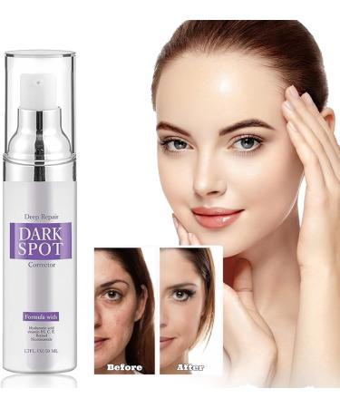 Dark Spot Correcting Glow Serum Skin Care Cor enne S rum Anti Taches Brunes Visage Whitening and Freckle Removing Essence Skin Care Face Body Cream Pour Peaux Ternes En Manque D' clat (50ML 1PC) 1PC 50 ml (Lot de 1) - Buy Online on GoSupps.com