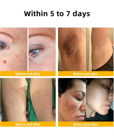 AAFQ Professional Bee Venom Treatment Cream 2024 Professional New Bee Venom Repair Cream Hydrating Moisturizing Treatment for Men&Women 1Fl Oz (1) - Buy Online on GoSupps.com