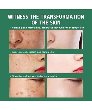 Dark Spot Remover for Face Body Dark Spot Corrector Age Spot Remover for Face Spot Cream with Niacinamide Vitamin C Reduces Hyperpigmentation Sun Spot Remover Blemish Freckle Reducer - Buy Online on GoSupps.com